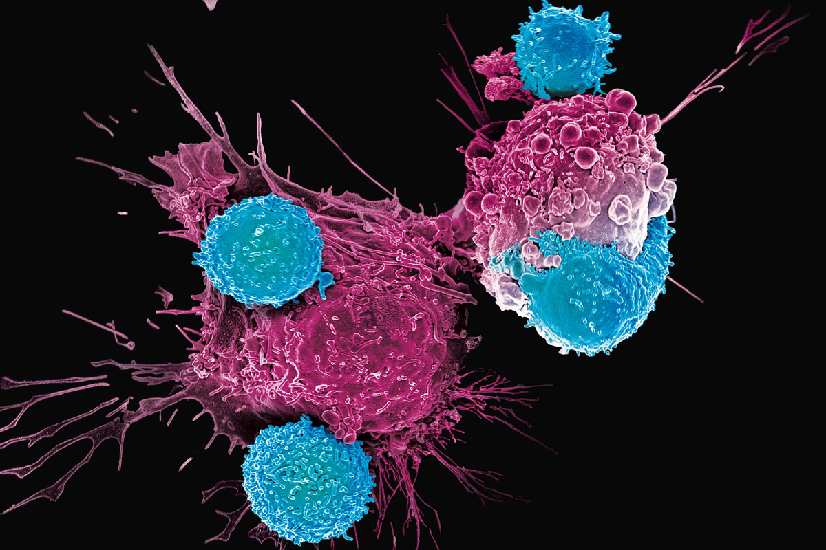 CAR-T for Multiple Myeloma