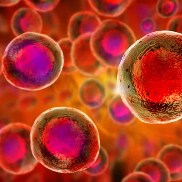 CAR-T Therapy Consultation
